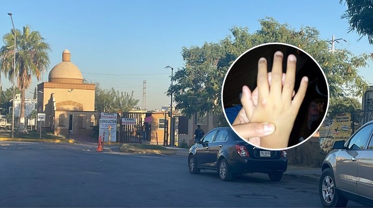 Alarma a padres virus manos, pies y boca en escuela de Apodaca