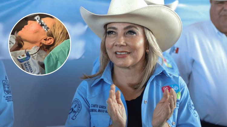 Reportan estable a alcaldesa de General Bravo tras caída de toro