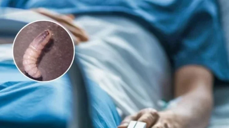 México confirma seis casos de miasis por gusano barrenador 