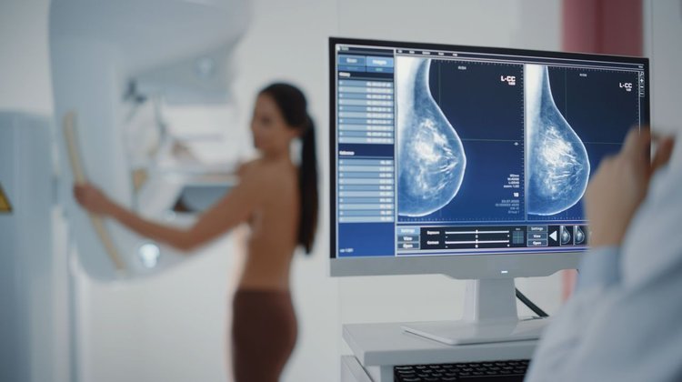 Detectar el cáncer a tiempo puede cambiarlo todo
