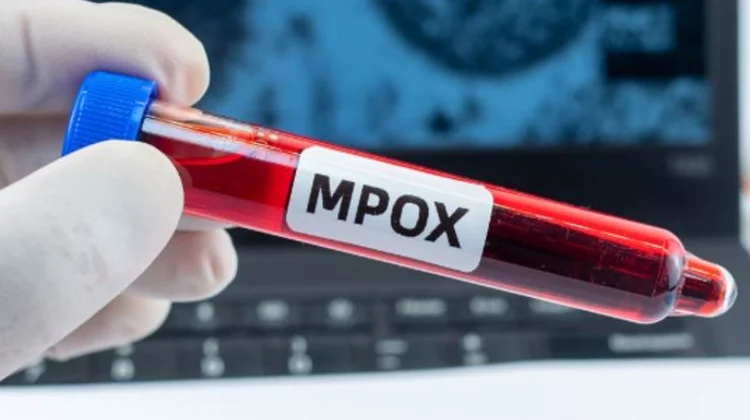 Aumentan a 99 los casos de Mpox en México, según SSA