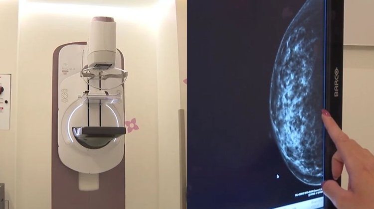 Nuevo León supera tasa nacional de mortalidad por cáncer de mama