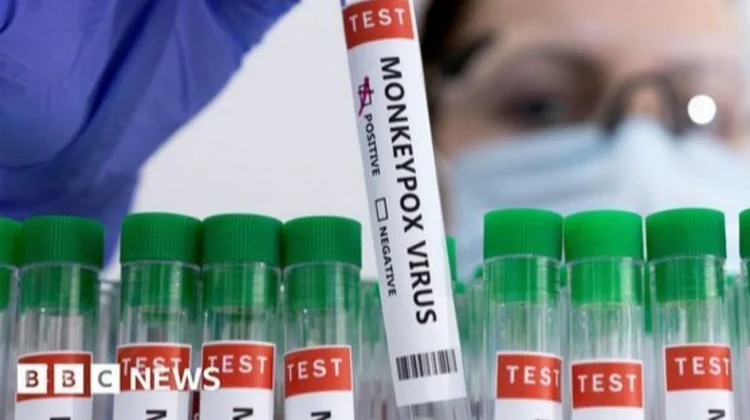 Ssa advierte a viajeros por brote de Mpox en África