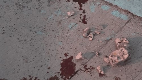 Golpean a adulto mayor que iba a trabajar en Matamoros