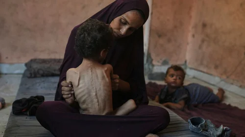 Decenas_de_ninos_en_Gaza_han_muerto_de_hambre_en_un_mes_33f53bfaa4