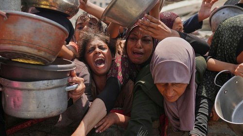 Desnutricion_en_Gaza_250_muertos_108_son_ninos_de1040a4b9