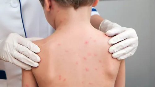 EH_UNA_FOTO_10_d8ba590256