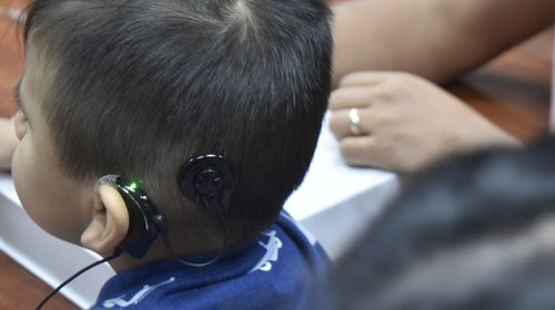 IMSS realiza histórico implante coclear a niño en Monterrey