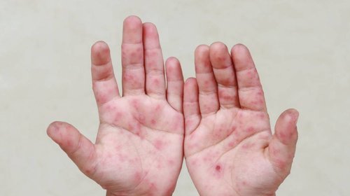 EH_UNA_FOTO_b9015841b1