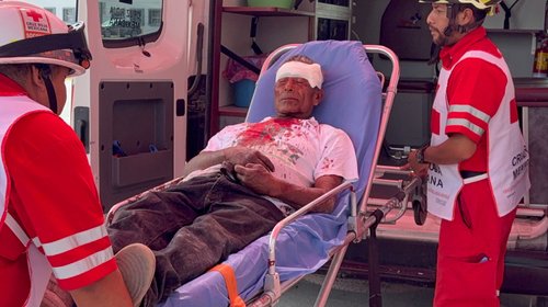 Golpean y asaltan a hombre de 65 años en la Avícola