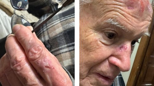 INFO_7_DOS_FOTOS_1_1cbf3c3c08