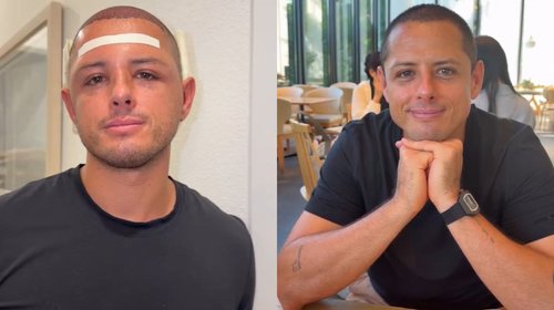 Se vuelve tendencia 'Chicharito' tras mostrar tratamiento capilar