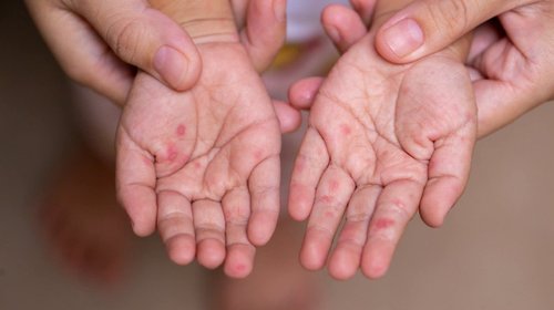 Whats_App_Image_2025_10_20_at_4_23_26_PM_1_50f4fcd4a1