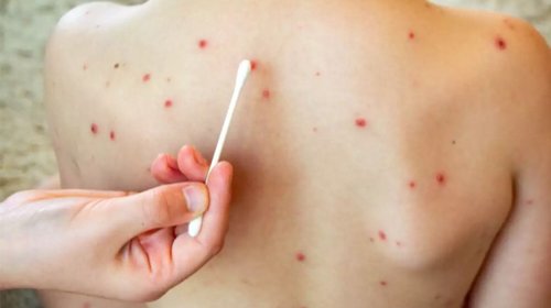 Whats_App_Image_2026_01_05_at_10_42_55_PM_881450ecc2