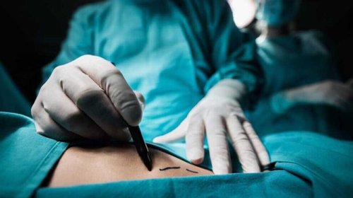 cirugia_estetica_16b817605b