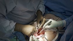 AP_25307798497744_0a83632761