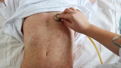 Cinfa_Salud_sarampion_600_1200x900_8b548bba40