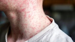 EH_UNA_FOTO_2026_01_28_T130556_259_1883161f52