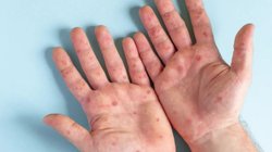 EH_UNA_FOTO_506037104d