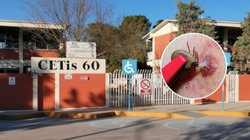 cetis_60_rickettsia_f1cfde659d