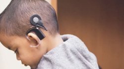 protesis_sordera_fe8791f2bd